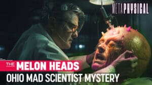 Dr. Frankenstein Lived in Ohio? Mystery of the Melon Heads & Mad Scientist Experimentation [Part 1]